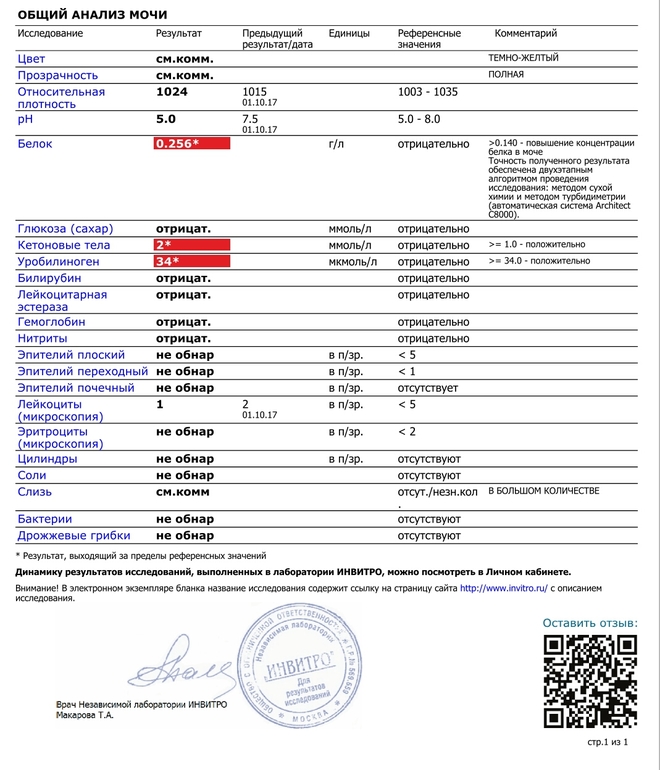 Анализ мочи. Общий анализ мочи. Общий анализ мочи анализ. Общий анализ мочи Результаты. Хороший общий анализ мочи.