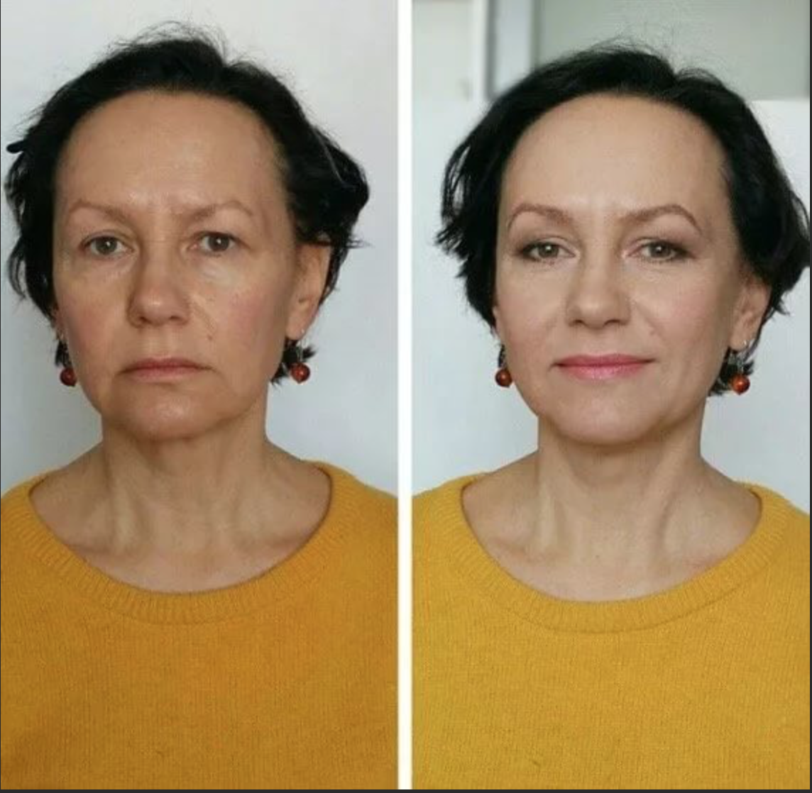 Изменения после 45. Лифтинг Нефертити ботоксом. Возрастной макияж до и после. Омоложение лица до и после. Макияж омолаживающий лицо.